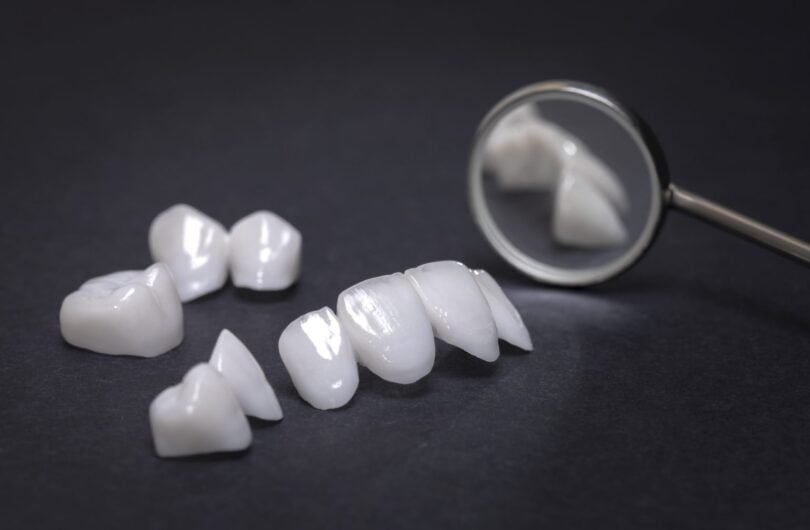Emax Veneers vs Zirconium Crowns: Lifespan, Overview, Problems, Strength