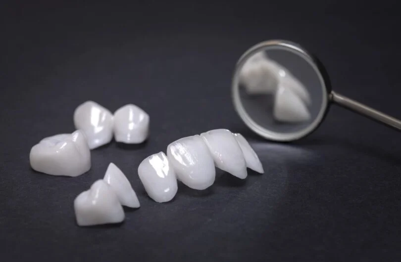 Emax Veneers vs Zirconium Crowns: Lifespan, Overview, Problems, Strength