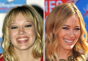 Hilary Duff Before / After